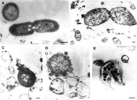 Transmission Electron Microscopy Of Ultrathin Sections Of Mycobacterium