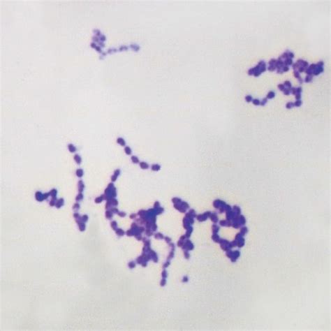 Streptococcus Pneumoniae Slide Cbs 064 Blades Biological Ltd Kent