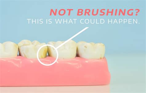 Four Side Effects To Not Brushing Your Teeth Cne Dental Blog