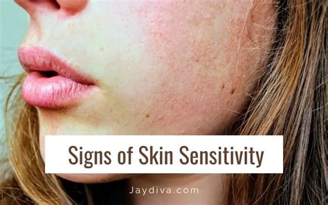 7 Signs Of Skin Sensitivity You Should Know About Jaydiva