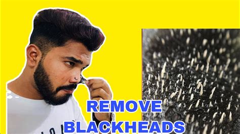 How To Remove Black Heads And White Heads In Telugu Ravinders