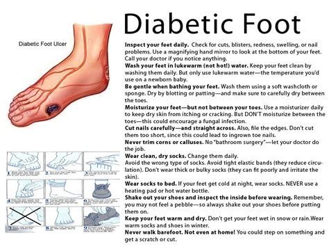 Maybe you would like to learn more about one of these? Symptoms of a Diabetic Foot one should know #diabeticfeet ...