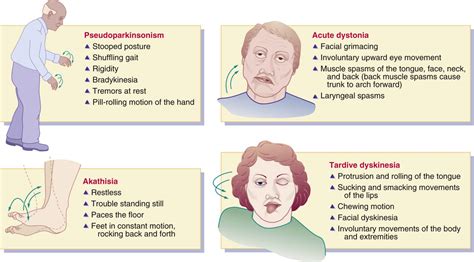 Is Tardive Dyskinesia A Symptom Of Parkinsons