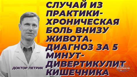 Диета дивертикулит кишечника Случай из практики - хроническая боль внизу живота. Диагноз за 5 минут Случай из практики - хроническая боль внизу живота. Диагноз за 5 минут Диета дивертикулит кишечника