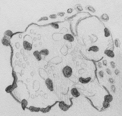 АЛКОГОЛИЗМ - Медицинский справочник Картинка - АЛКОГОЛИЗМ - Медицинский справочник