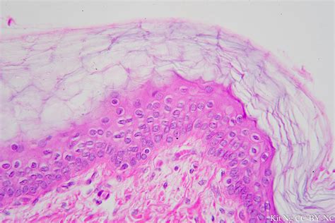 Is Dermis Made Of Keratinized Stratified Squamous Epithelium Steve Gallik