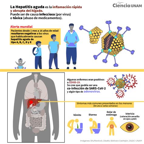 Posibles Causas De La Hepatitis Aguda Infantil Ciencia Unam