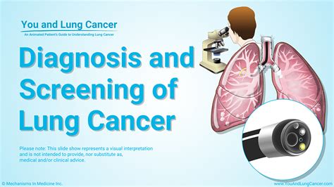 This is done to evaluate symptoms and risk factors for lung cancer, and to look for if the ct is abnormal, the diagnosis of lung cancer still needs confirmation through examination of a sample of lung tissue. Diagnosis and Screening of Lung Cancer