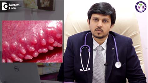 How To Treat Pearly Penile Papules Dr Sanjay Panicker Youtube