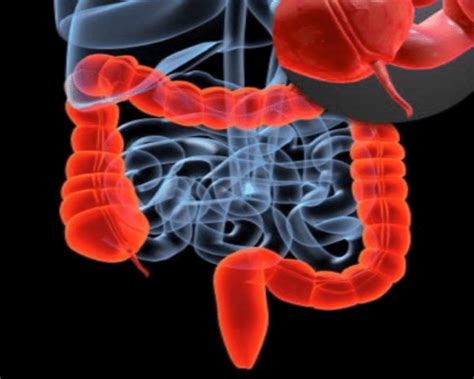 appendix operation cost in hyderabad appendectomy specialist