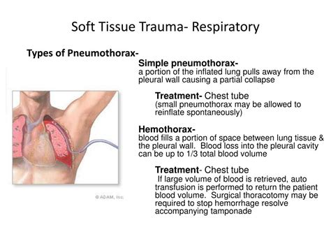 Ppt Soft Tissue Injury Powerpoint Presentation Free Download Id 1634436