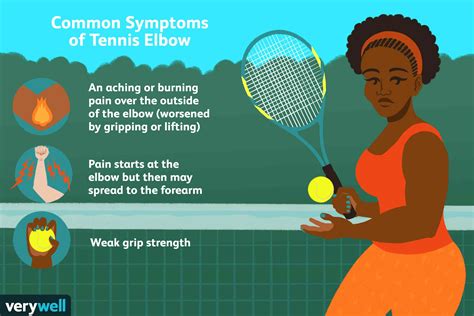 How do i know if i have tennis elbow? Tennis Elbow: Symptoms, Causes, Diagnosis, and Treatment