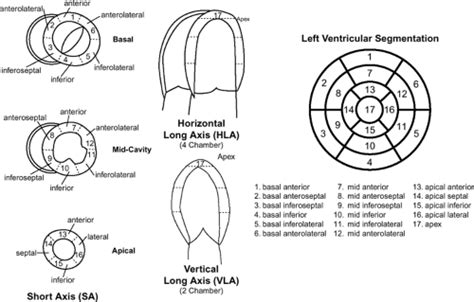 Heart Thoracic Key Thoracic Cavity Cardiac Disease Body Organs