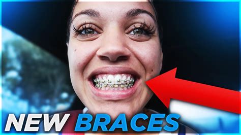 She Got Braces ️ Youtube