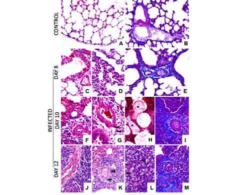The Histology Of Lungs From Ascaris Suum Infected Balbc Mice The Lung