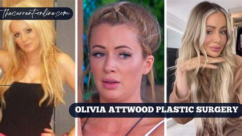 Olivia Attwood Plastic Surgery Her Wild Transformation And How Different Shes Looked Over The Years