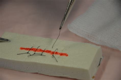 44 Suture Removal Clinical Procedures For Safer Patient Care