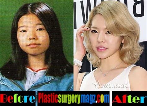 Snsd Jessica Plastic Surgery Before And After