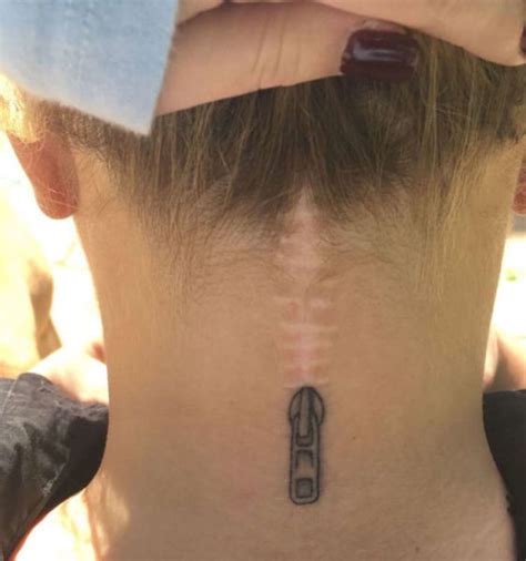 15 Awesome Tattoos That Turn Scars Into Clever Works Of Art