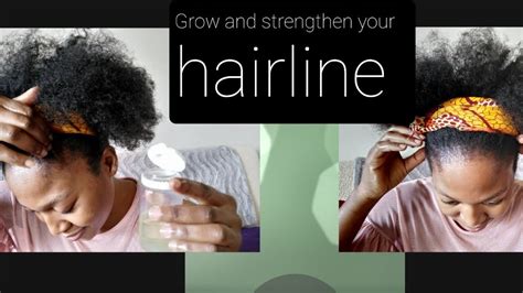 How To Grow And Strengthen Your Hairline Youtube