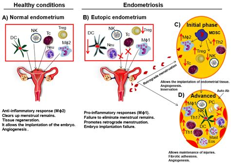Ijms Free Full Text The Role Of Peritoneal Macrophages In Endometriosis