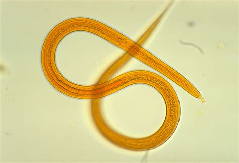 Worms In Humans Skin