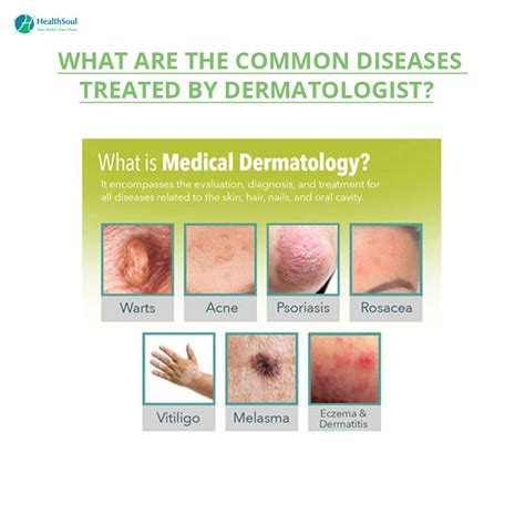 Learn About Dermatologists Diseases They Treat And When To See One
