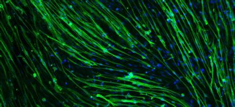 Generation of muscle cells in 3 easy steps | Scientist Live
