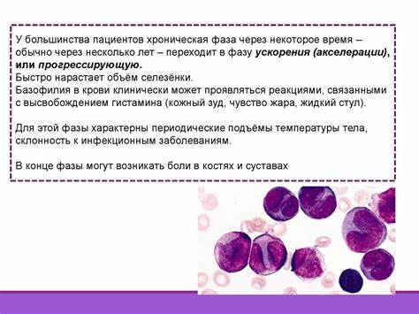 Лейкоз хронический диета Хронический миелобластный лейкоз у детей - презентация онлайн Хронический миелобластный лейкоз у детей - презентация онлайн Лейкоз хронический диета