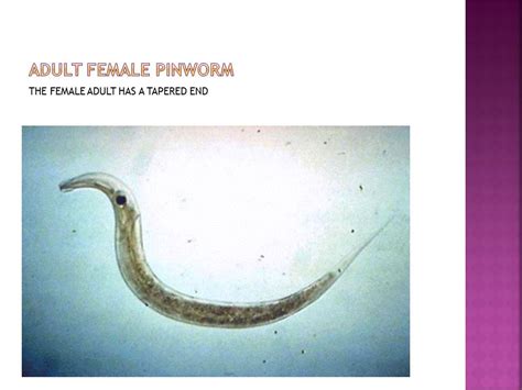 Enterobius Vermicularis A Worm That Knows No Class Race Or Culture 635 Words Presentation