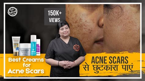 how to get rid of acne scars acne scar removal cream acne scar cream review dr nivedita