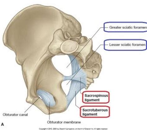 Piriformis syndrome is often a misdiagnosed cause of low back pain and sciatica secondary to sciatic nerve entrapment in piriformis muscle at the greater sciatic notch. Pelvis & Perineum I and II - Anatomy Clinical with ...