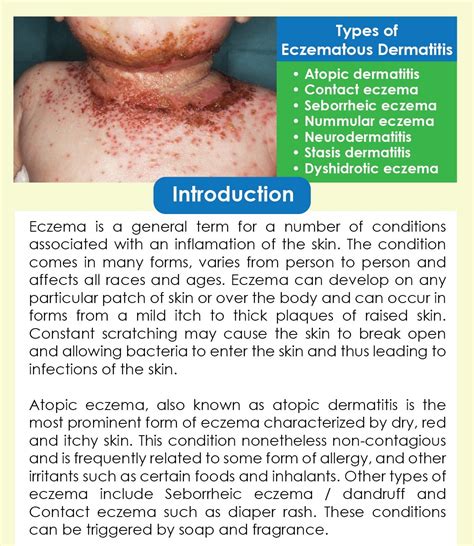 Types Of Eczematous Dermatitis Xukin K