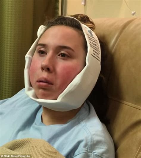 Wisdom teeth swelling can be. Oklahoma girl is left in tears following wisdom tooth ...