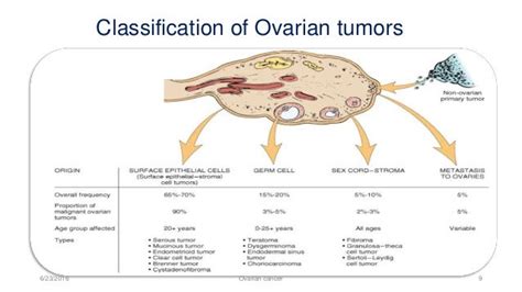 Ovarian Low Malignant Potential Tumors Pictures
