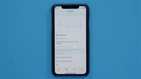 Hands On With The Ecg Feature For Apple Watch Series 4 Macrumors