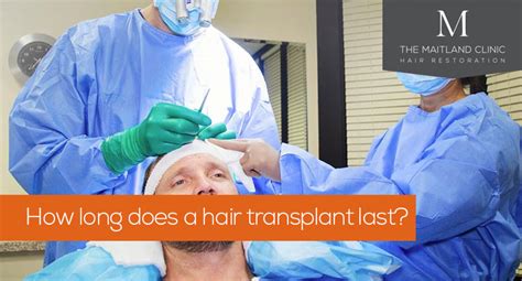 The answer varies from patient to patient but when the procedure is performed by a highly skilled hair restoration specialist, a hair transplant can last a lifetime. How Long Does a Hair Transplant Last For? (FUE & FUT Years)