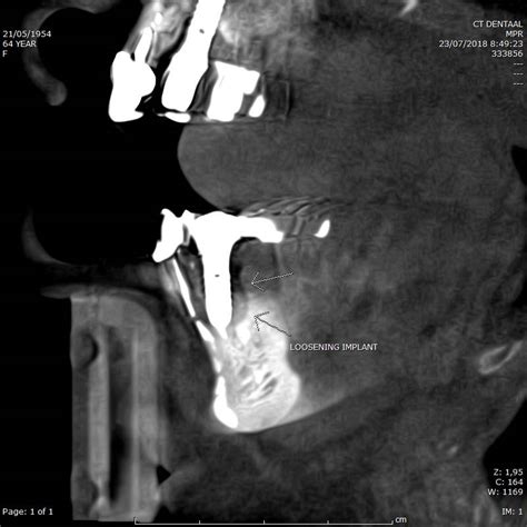 Cone Beam Ct Dental Radiologie Dr Fr Cuigniez