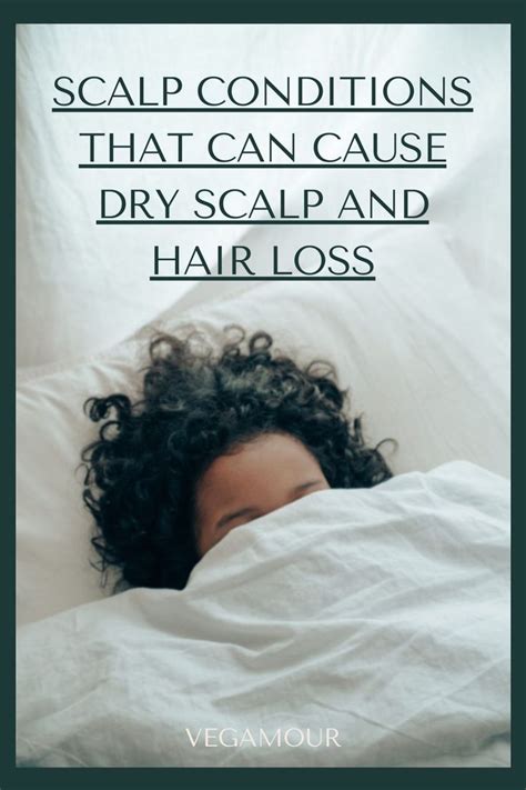 experiencing dry scalp and hair loss read this dry itchy scalp treatment dry scalp hair loss