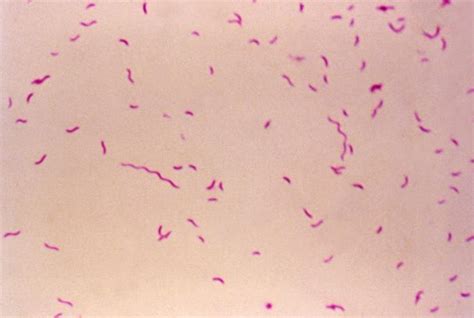 Campylobacter Fetus Wikidoc