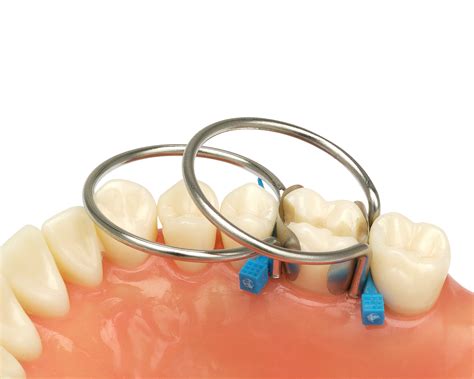Garrison Original Sectional Matrix System Clinical Research Dental