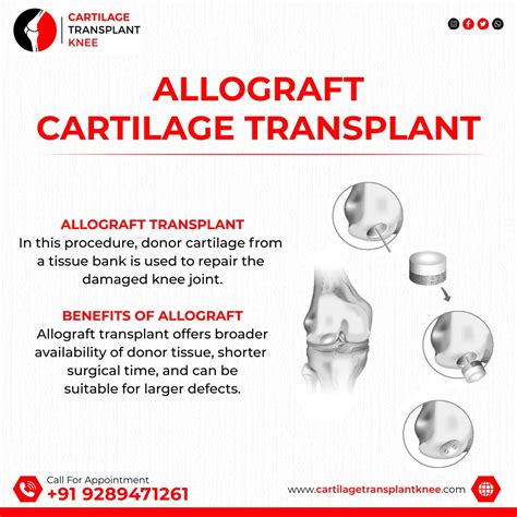 Ppt Reviving Knee Health Unveiling The Types Of Cartilage Transplant