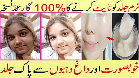 Get Fair Glowing Spotless Skin Permanently Better Results For Losing
