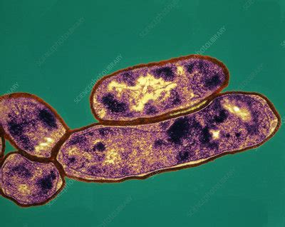 It mainly affects the nose and throat. Diphtheria bacteria, TEM - Stock Image - B220/1362 ...