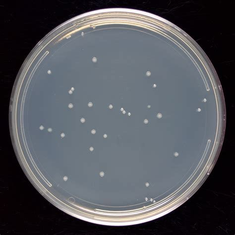 Colonies On A Plate Science In The News
