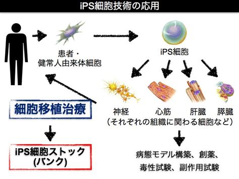 It was designed to solve the main limitations of the twisted nematic field effect (tn). iPS細胞の臨床応用 | Naka lab