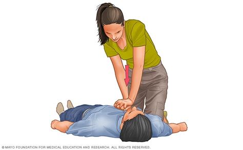 Si bien la rcp (reanimación cardiopulmonar) debe sigue estos pasos, actualizados para reflejar las directrices de 2010 de la asociación americana de salud, para aprender a realizar rcp en niños. Imparten curso de reanimación cardiopulmonar en UABC ...