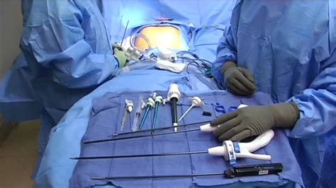 Single Site Laparoscopic Cholecystectomy Introduction And Instruments