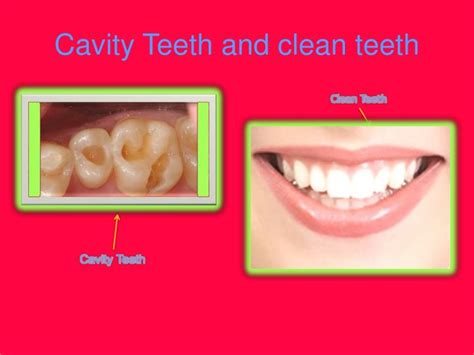 Ppt How To Keep Your Teeth Clean Powerpoint Presentation Id2497293