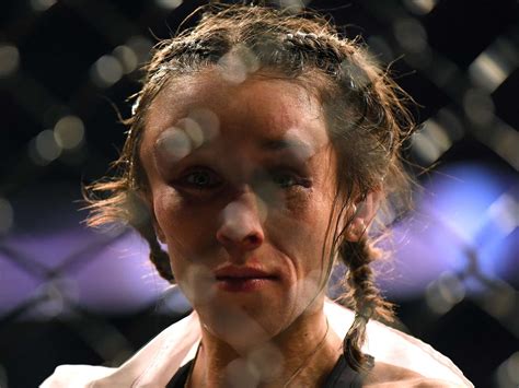 Joanna Jedrzejczyk Shows Off Healing Forehead After Suffering Horror